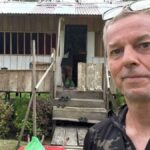 homem-descobre-sanguessuga-no-olho-em-viagem;-veja-foto