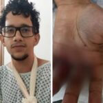 bombinha-em-bolo:-o-que-se-sabe-sobre-explosao-que-deixou-jovem-ferido-durante-festa-de-aniversario 