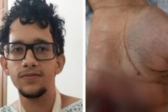 bombinha-em-bolo:-o-que-se-sabe-sobre-explosao-que-deixou-jovem-ferido-durante-festa-de-aniversario 