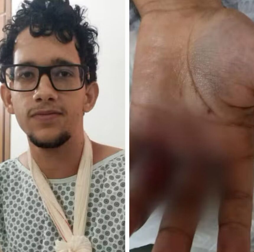 bombinha-em-bolo:-o-que-se-sabe-sobre-explosao-que-deixou-jovem-ferido-durante-festa-de-aniversario 