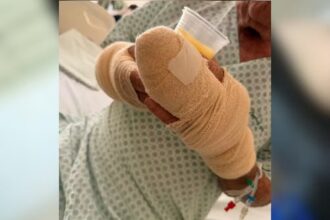 idoso-fica-gravemente-ferido-apos-ser-atacado-por-pitbull-em-palmas