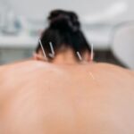 lei-regulamenta-exercicio-profissional-da-acupuntura