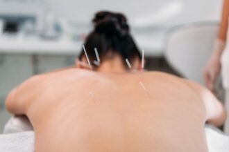 lei-regulamenta-exercicio-profissional-da-acupuntura