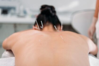 lei-regulamenta-exercicio-profissional-da-acupuntura