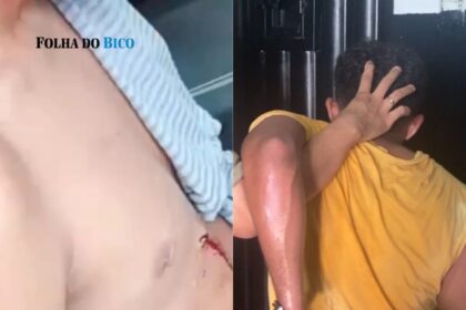 araguatins:-influenciador-luan-do-forro-e-encontrado-ferido-na-manha-de-sabado-apos-agressao-durante-a-madrugada.-suspeito-e-preso