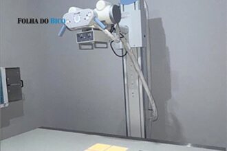 ananas:-apos-anos-parado,-aparelho-de-raio-x-finalmente-comeca-a-funcionar