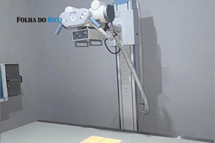 ananas:-apos-anos-parado,-aparelho-de-raio-x-finalmente-comeca-a-funcionar