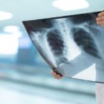comissao-de-saude-debate-incorporacao-da-terapia-tripla-para-tratamento-da-fibrose-cistica
