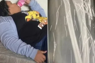 mulher-que-fingiu-ter-12-anos-relatou-agulhas-no-corpo